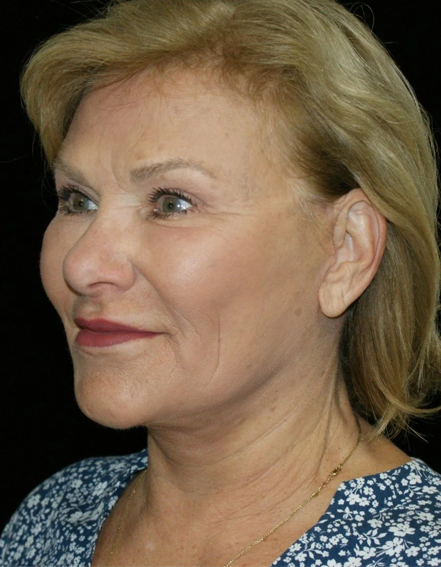 Barb 3 after.jpg