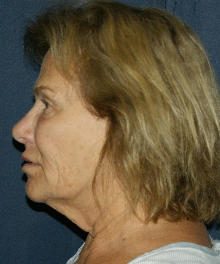 Barb 4 before.jpg