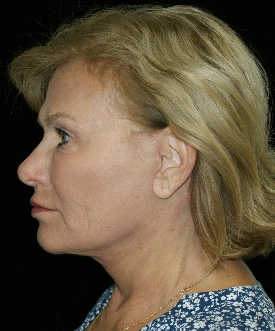 Barb 4 after.jpg