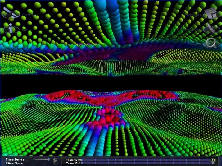 What is Magnetic Resonance Imaging?