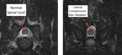 What is Wobbler's Disease?