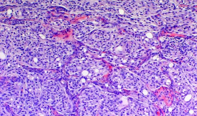 Brain tumors in dogs and cats