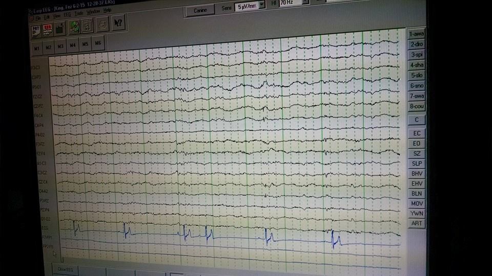 This is our Electroencephalogram in action ...