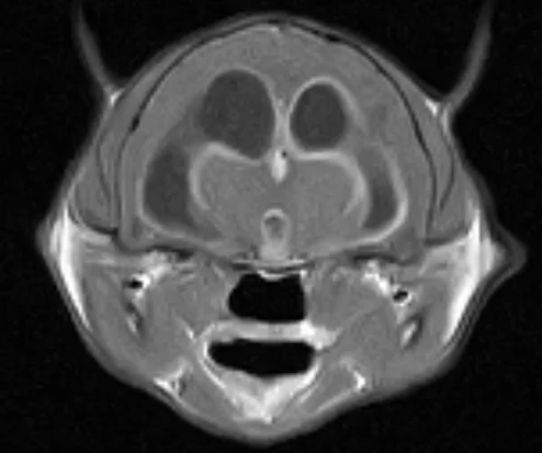 An MRI image of a cat as if the cat were looking out of the screen at the viewer. The bright lines outline the ventricles (normal fluid filled spaces in the brain). But the ventricles are swollen and dilated from the disease. The lining is bright white because of the inflammation or granuloma formation secondary to the virus.