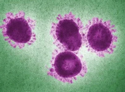 What is Feline Infectious Peritonitis (FIP)?
