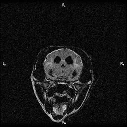 What is Canine Cognitive Dysfunction?