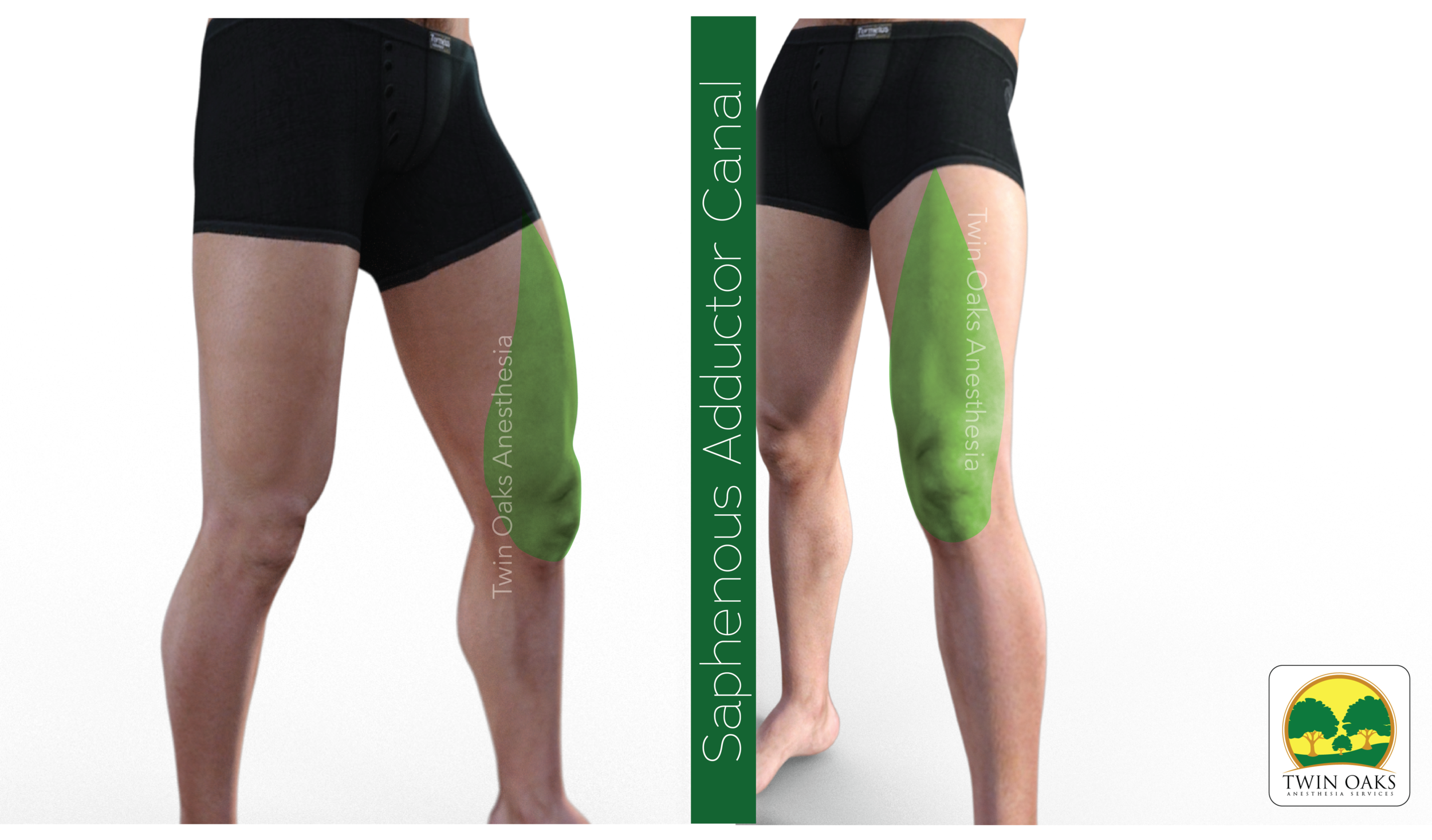 Saphenous Adductor.png