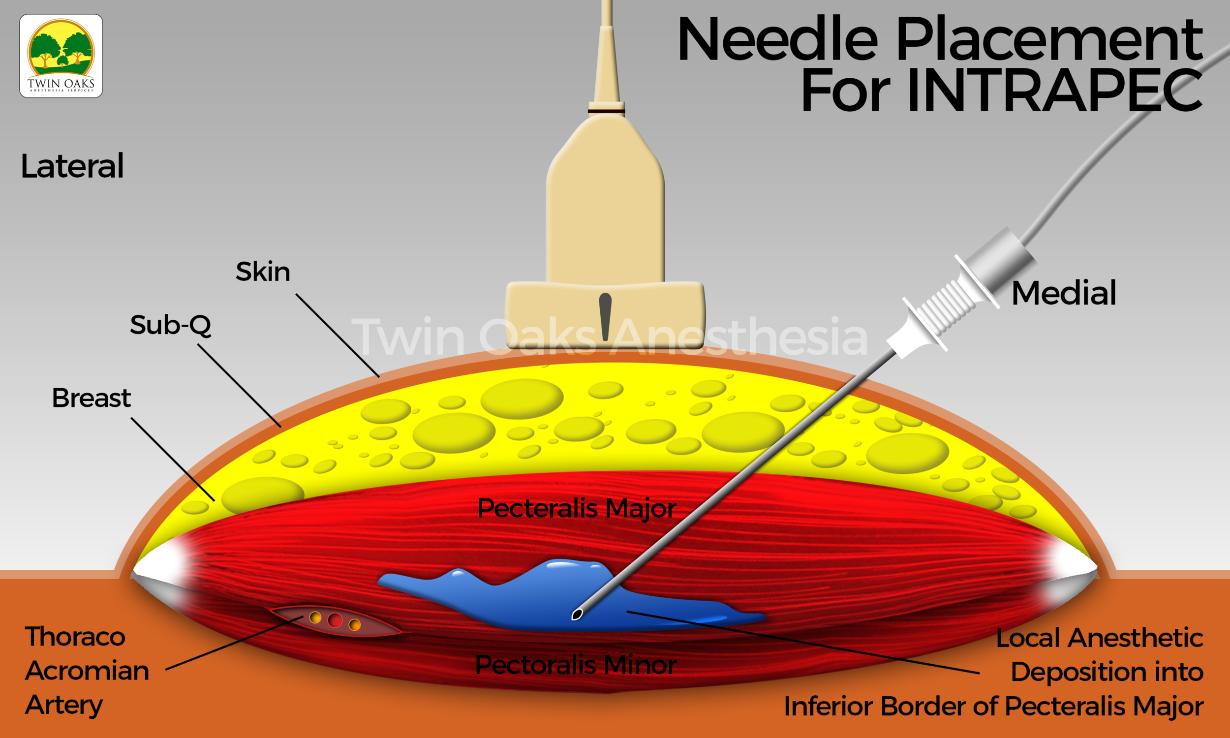INTRAPEC v2 final.png