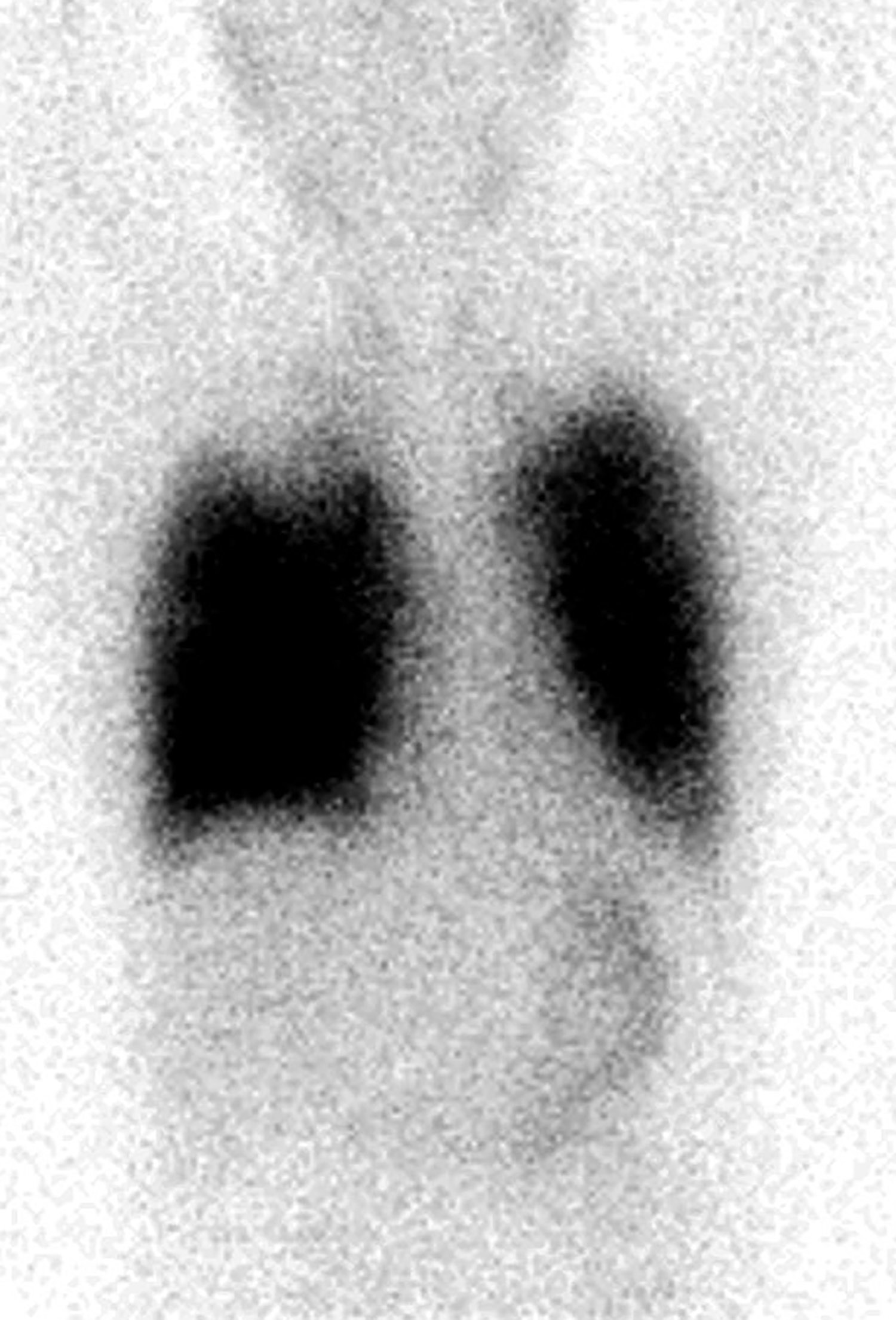 lungs for website.jpg