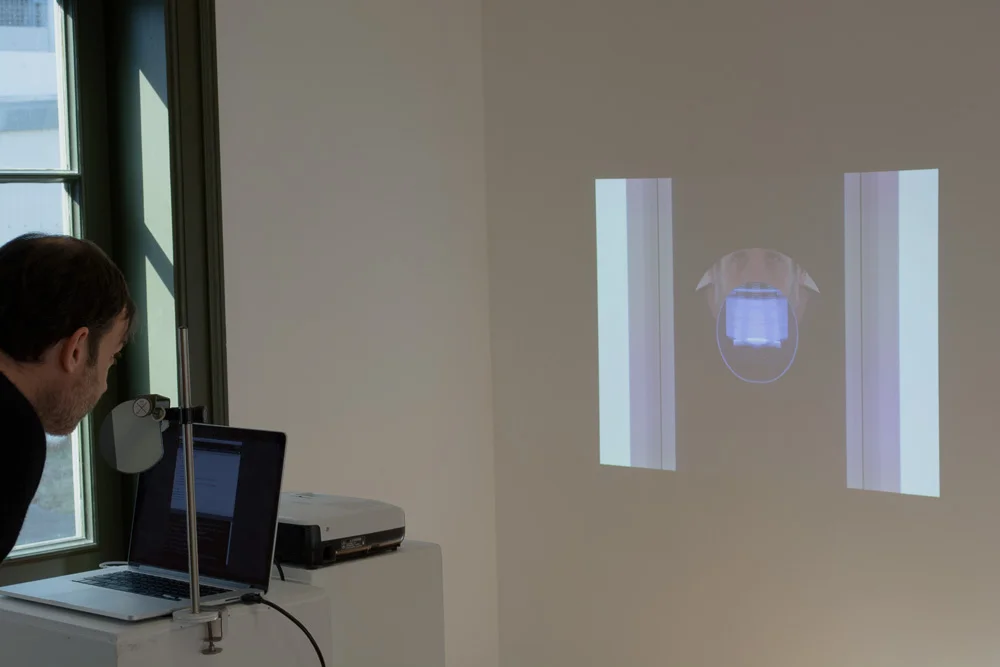 autologousReflection