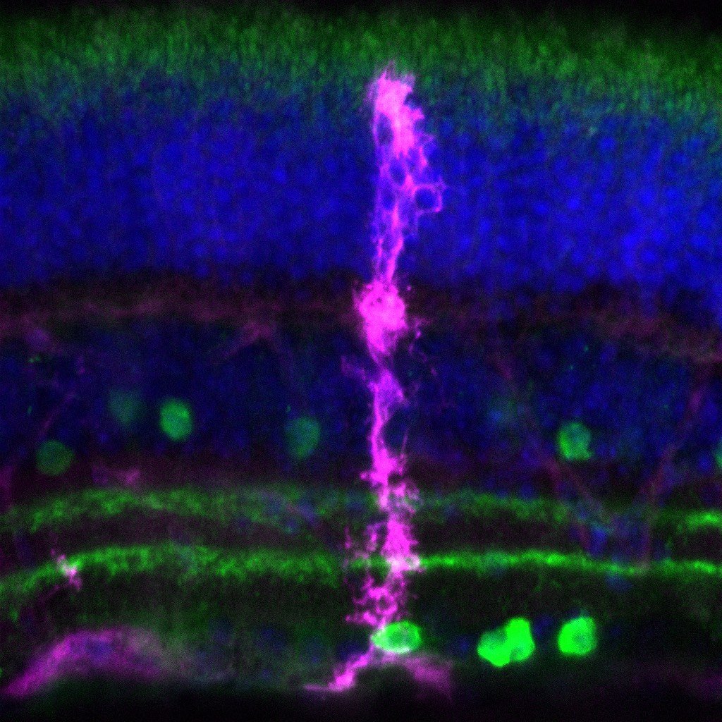 retinal glial cell.jpg