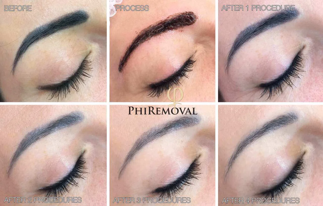 Before and After Photos — Houston's Premier Brows Boutique Experts in sculpting eyebrows in