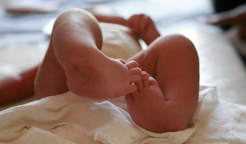 Children and adults born with Clubfoot