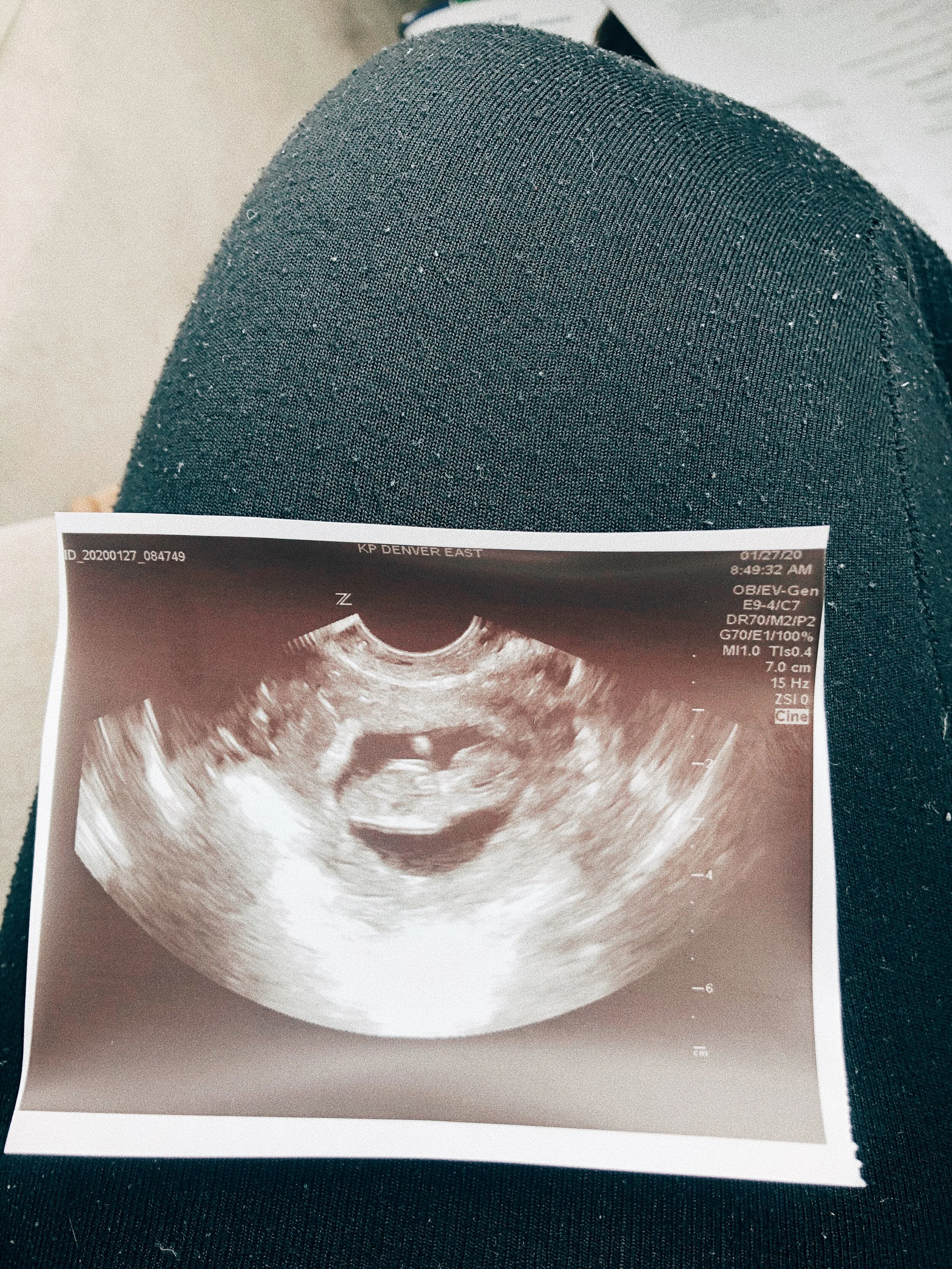 Baby Wong: First Trimester