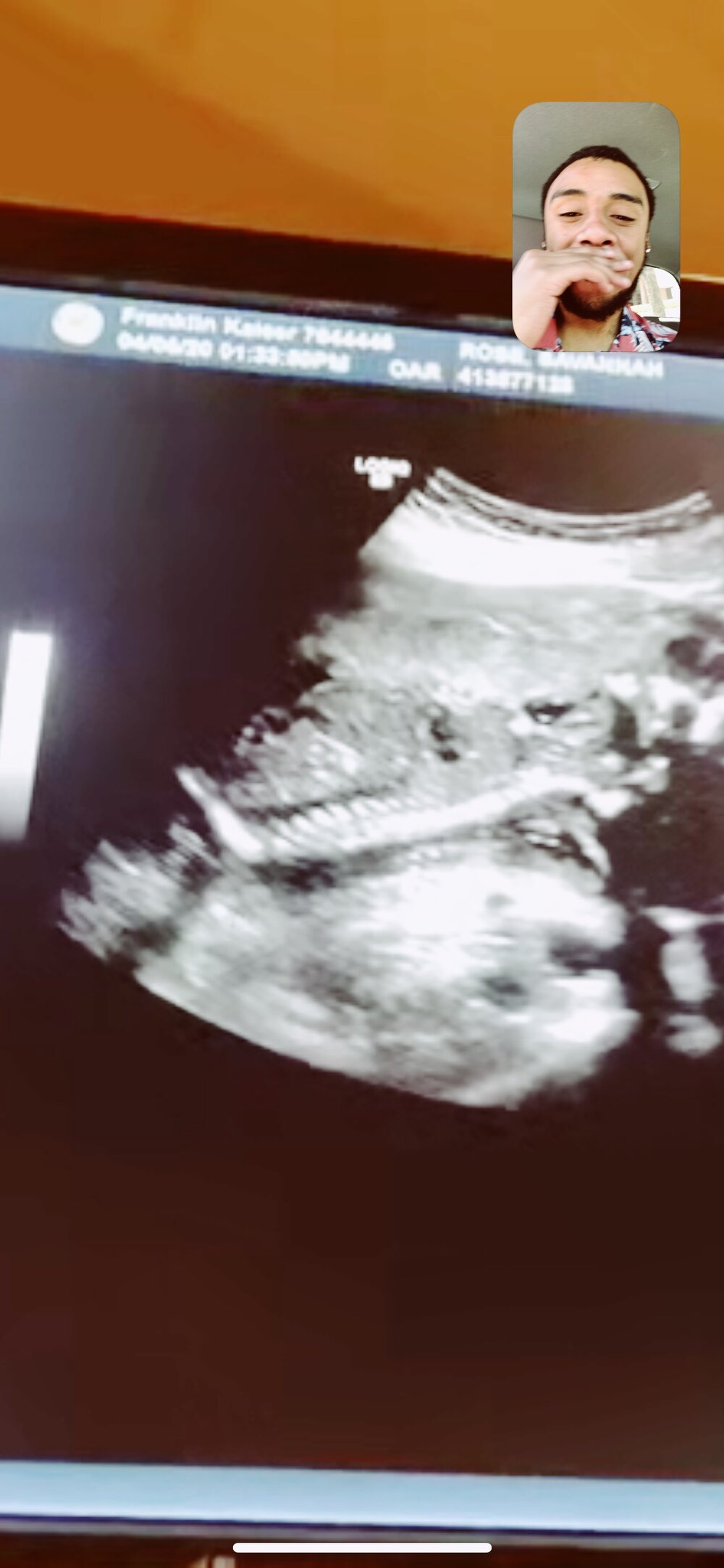 Baby Wong : Second Trimester | SaltWaterVibes