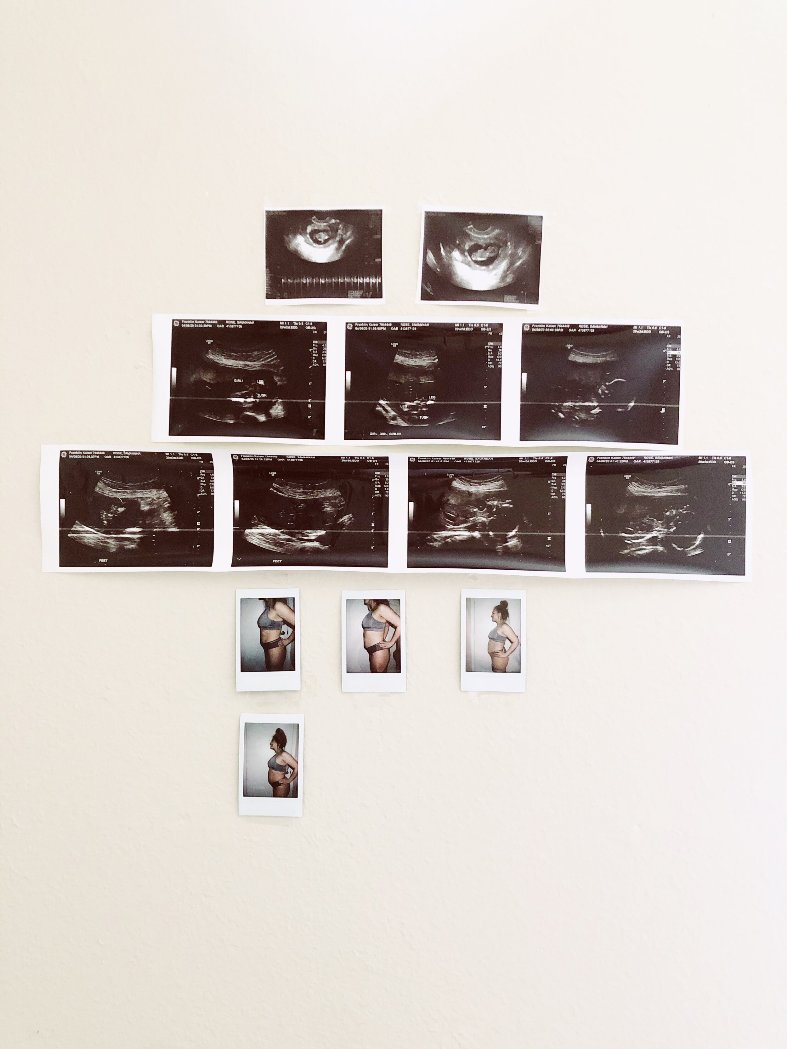 Baby Wong : Second Trimester | SaltWaterVibes