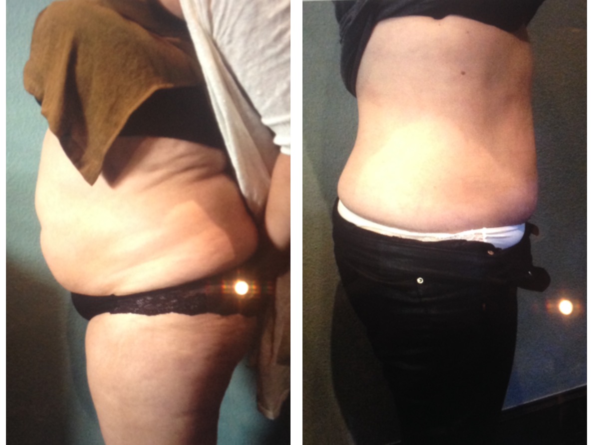 After 10 Sessions