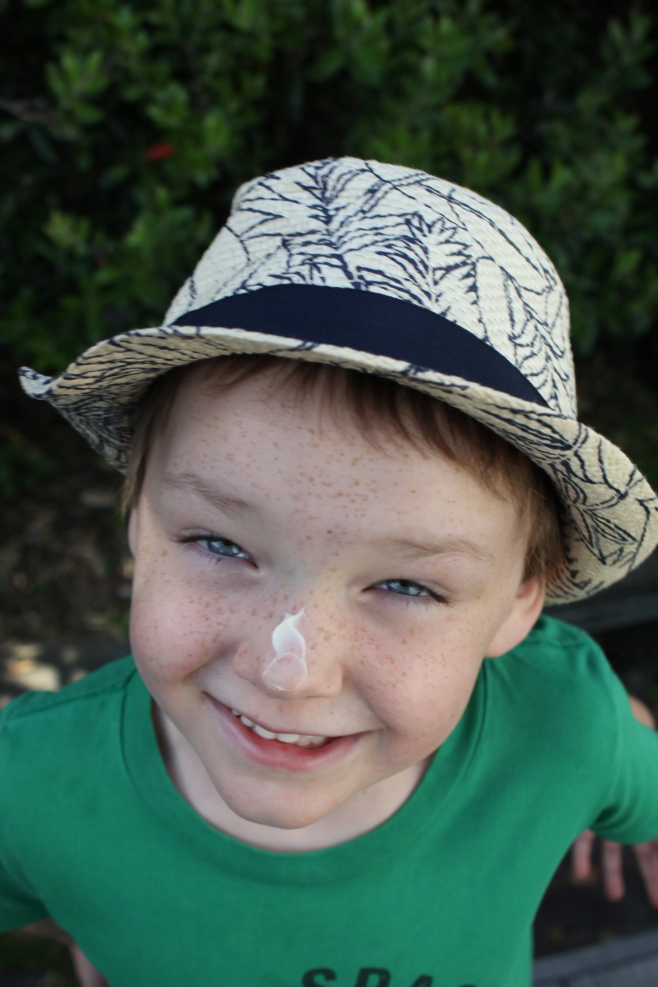 Spotting sunstroke in the under-5's: A quick guide