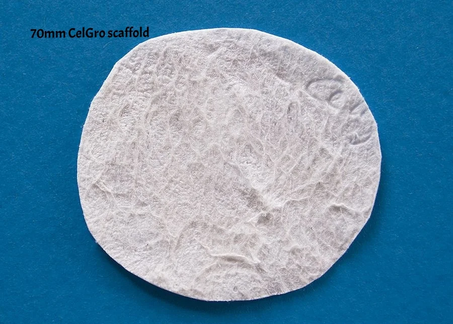 Ortho Celgro 03b RTP_6056.jpg