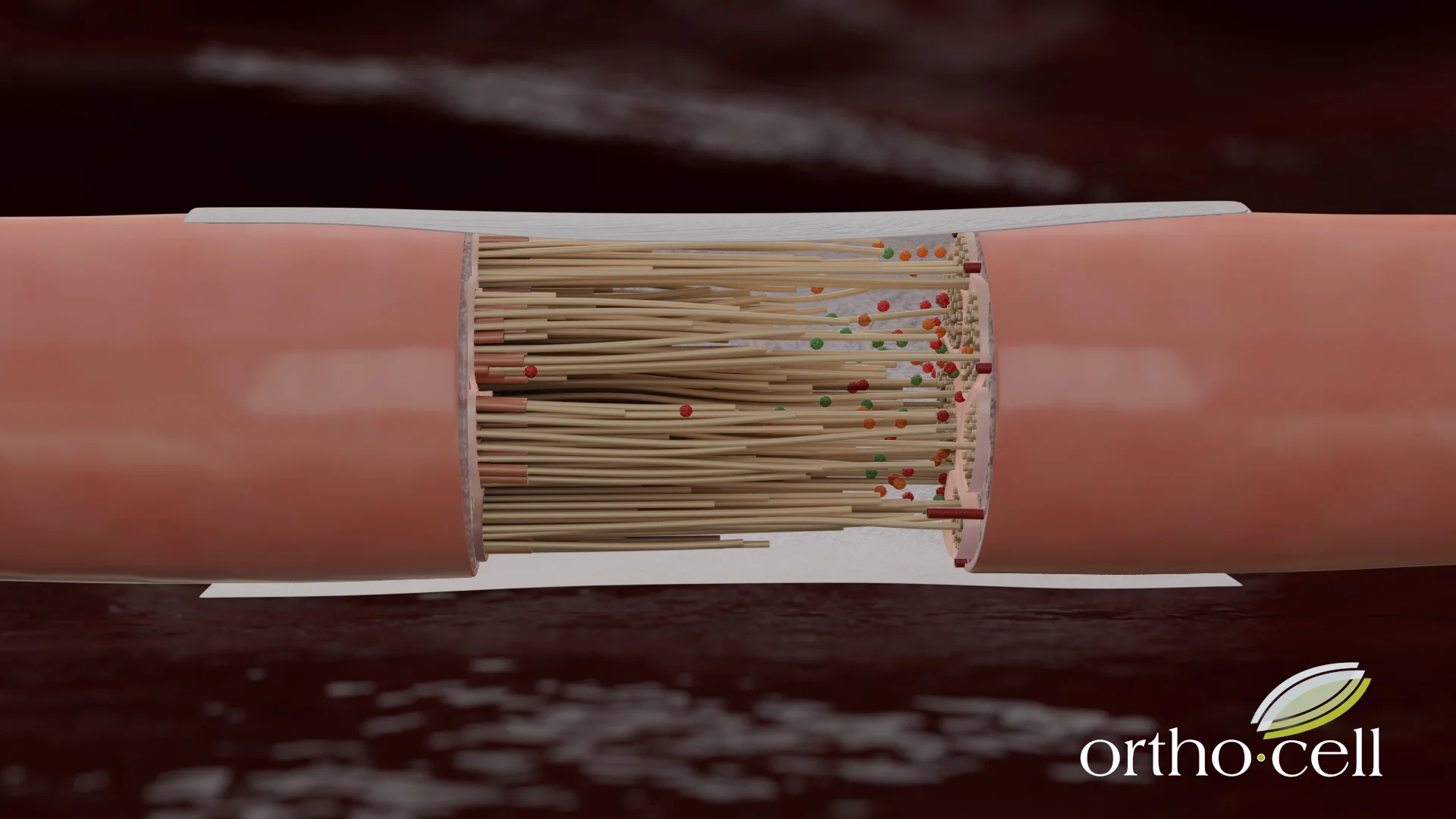 4. CelGro™ guides and supports nerve repair New nerve fibres reconnect