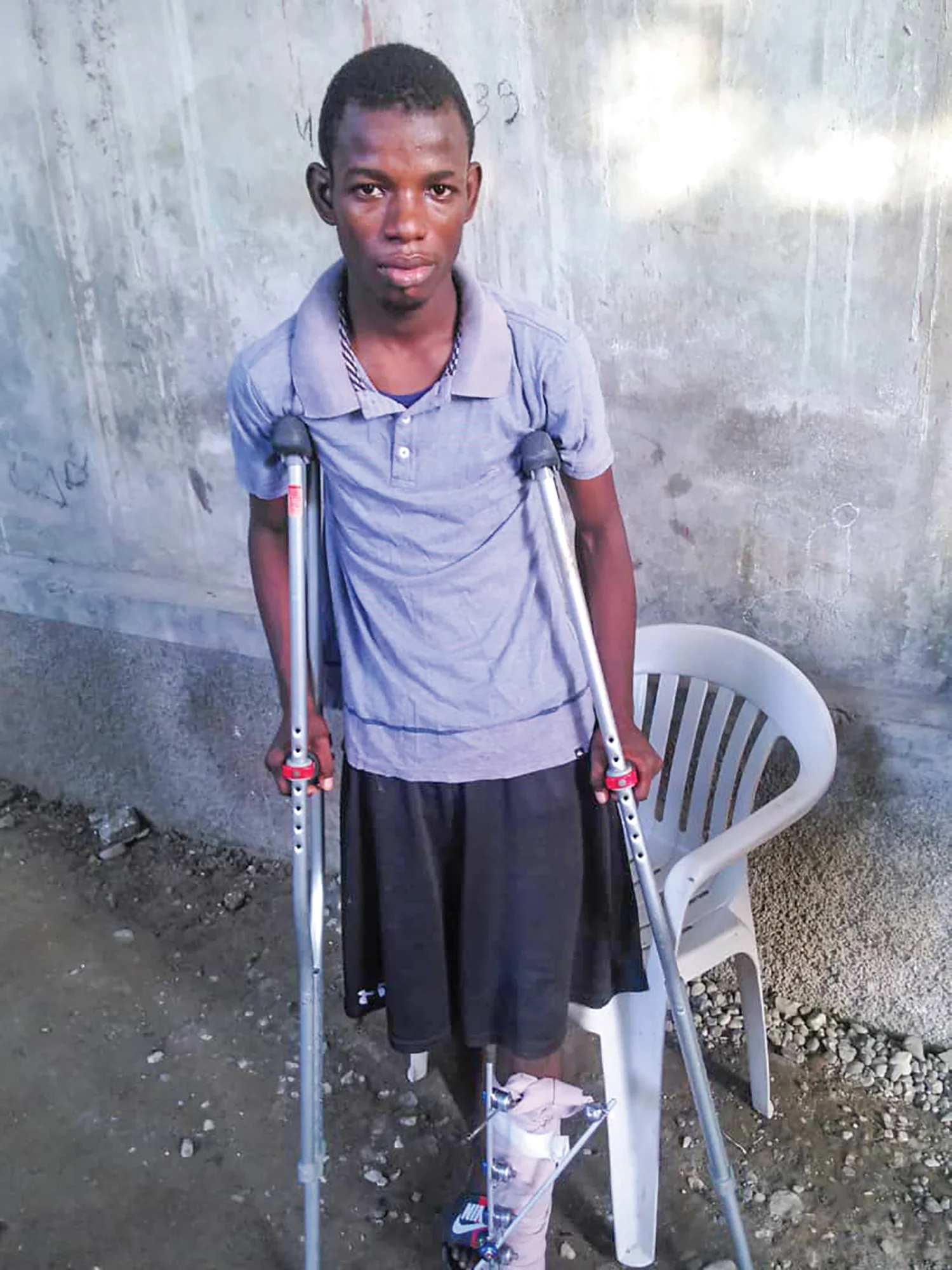 Wilnes Lapeine after his surgery. He is a good student and active in his church.