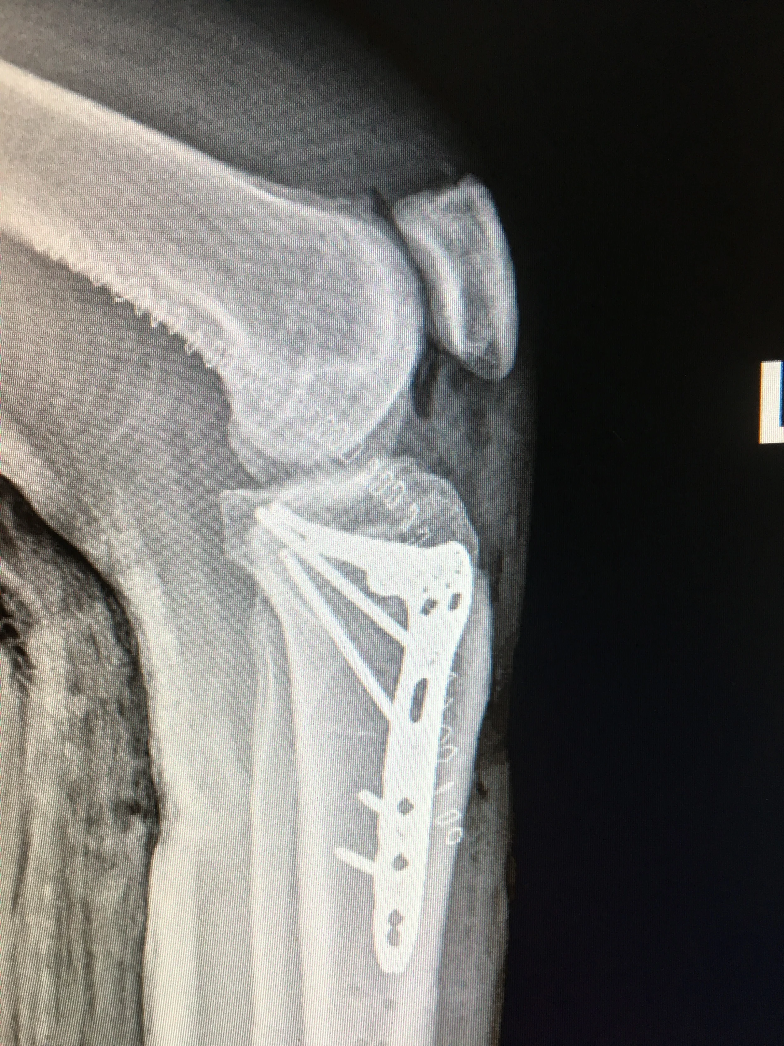 Left knee