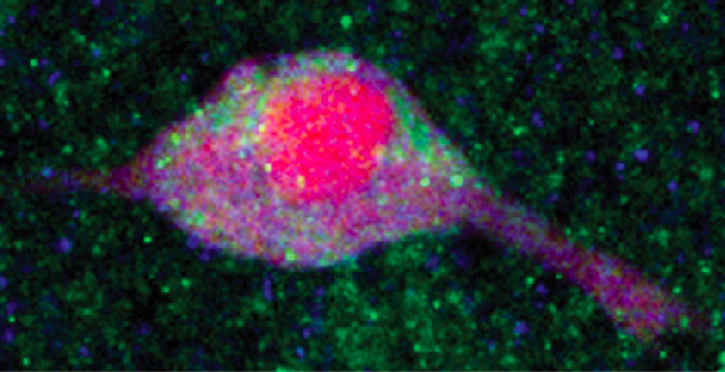 Insulin receptors (InsRs) on striatal cholinergic interneuron (ChI). Electrophysiologically identified ChI triple labelled for biocyin (red, from the recording pipette), acetylcholine synthesis (blue, choline acetyltransferase, ChAT), and InsRs (green). Activation of InsRs increases ChI excitability and enhances release of dopamine, a key reward pathway transmitter. Adapted from Stouffer et al., 2015.