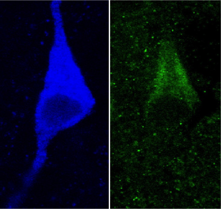 Insulin receptors (InsRs) on a striatal cholinergic interneuron (ChI). ChI identified by immunolabelling acetylcholine synthesis (blue, choline acetyltransferase) expresses InsRs. Activation of InsRs increases ChI excitability and enhances DA release. Adapted from Stouffer et al., 2015.