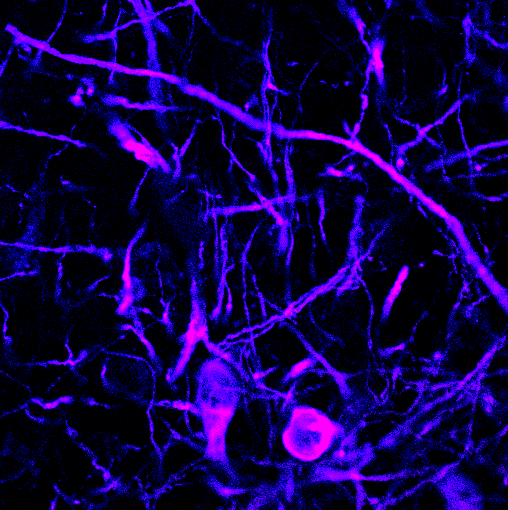 Immunofluorescence staining showing colocalization of tyrosine hydroxylase (labelled in blue) and the SNARE protein SNAP-25 (labelled in red) in both the somata and the dendrites of midbrain dopamine neurons.