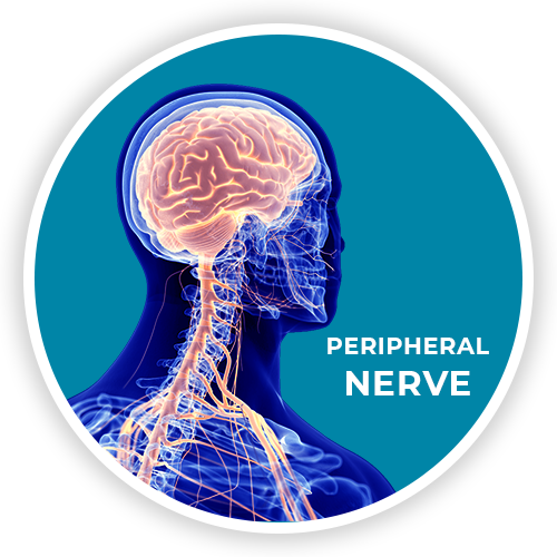 Leg pain, hand and arm pain such as carpel tunnel or ulner nerve