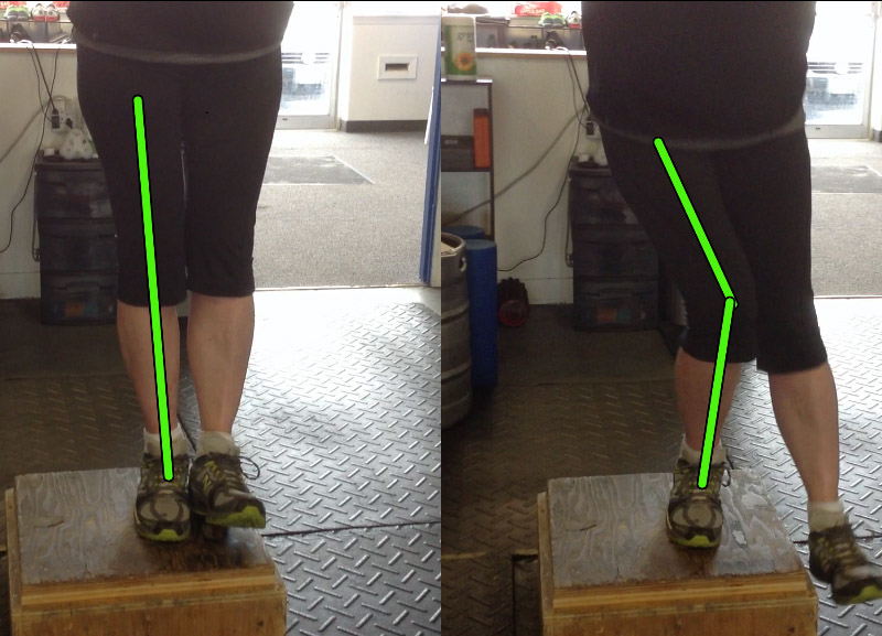 Step-up fail: the knee caves in as the client performs the movement.