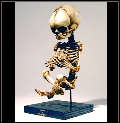 Baby Skeleton