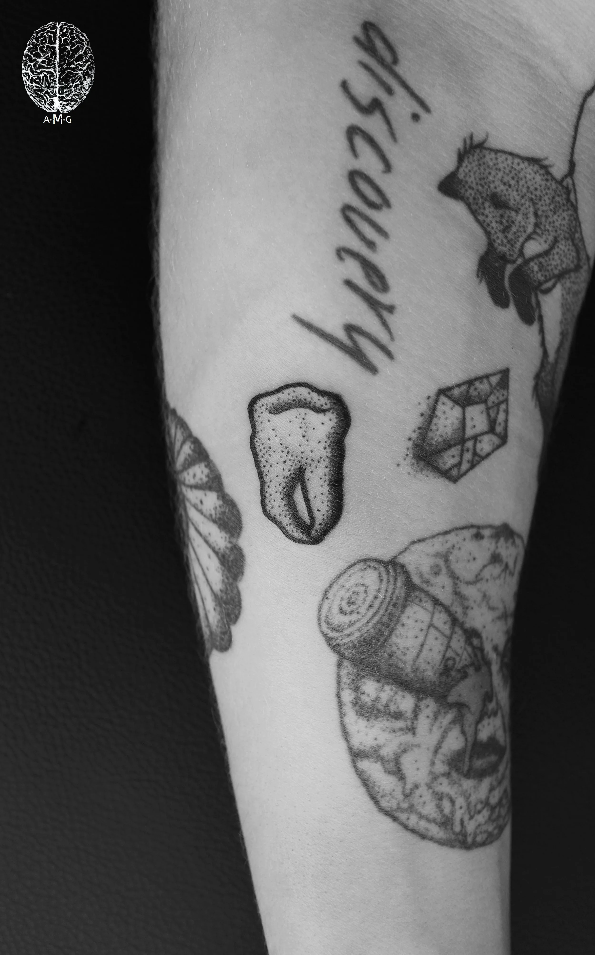 Premolar #2