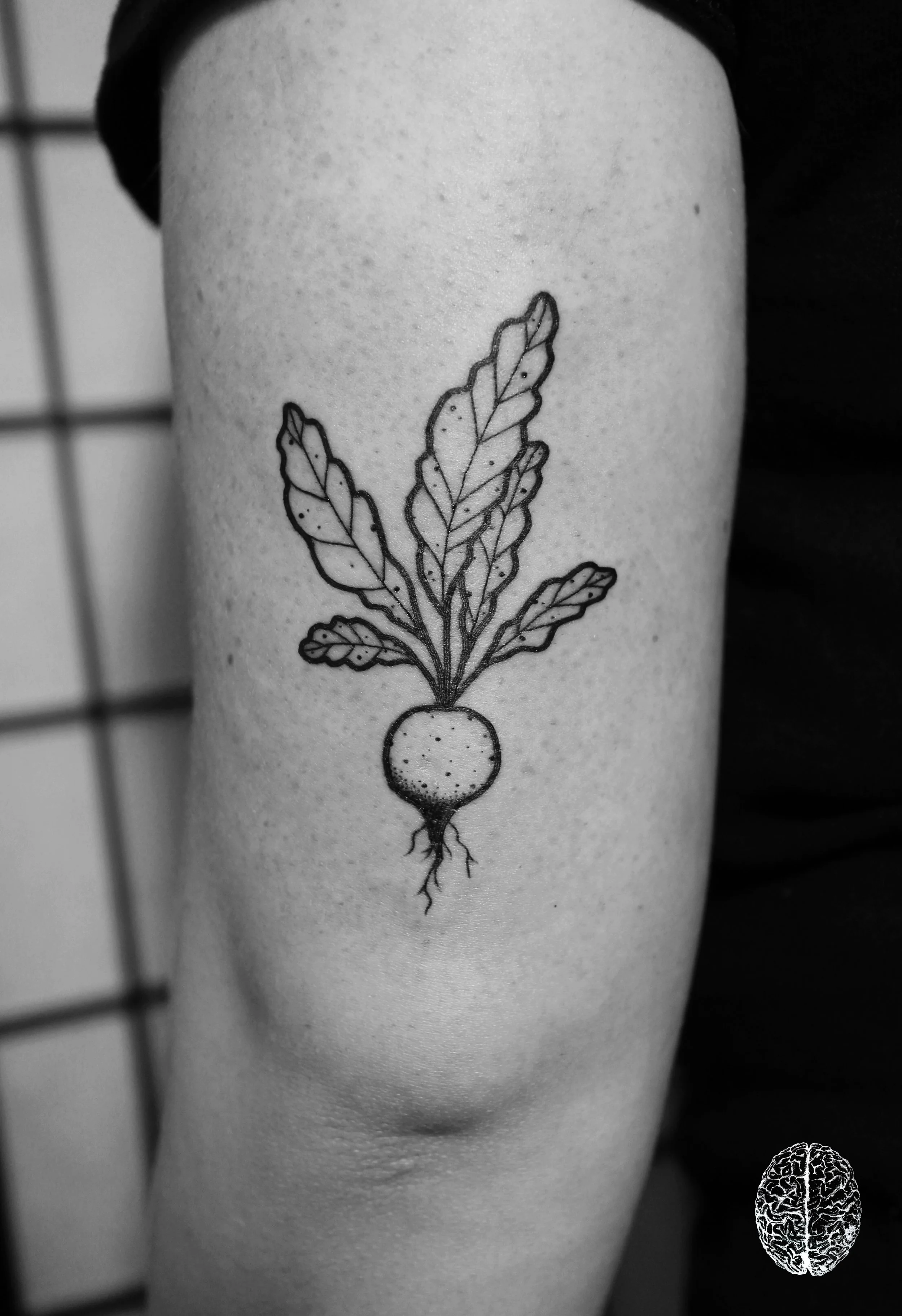 Radish