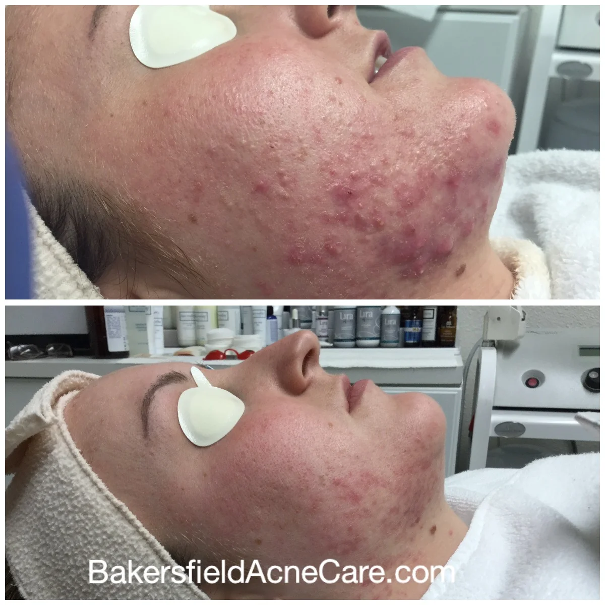 These results happened in 49 days!