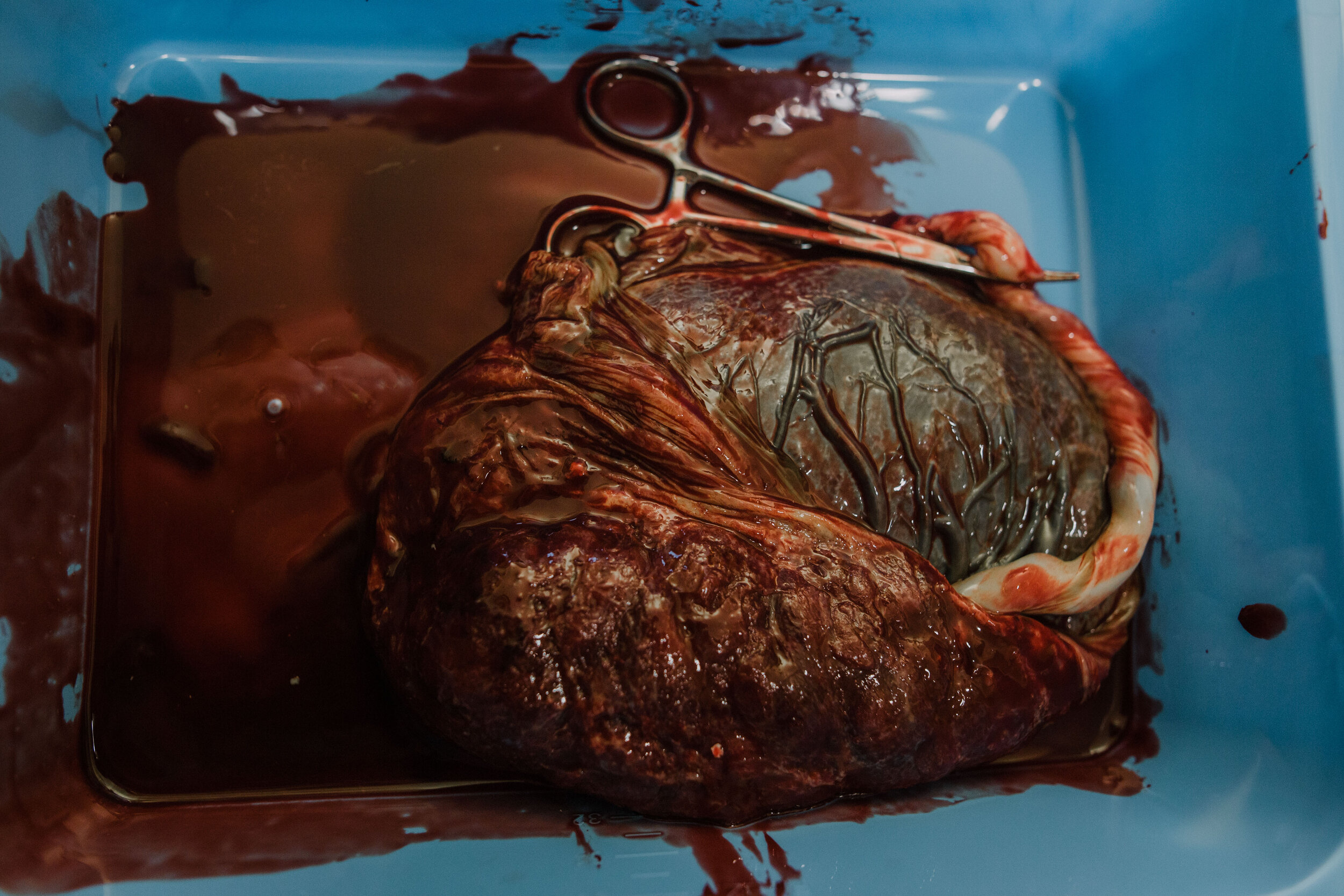 belinda birth final-285.jpg