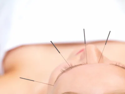 facial rejuvenation B.jpg