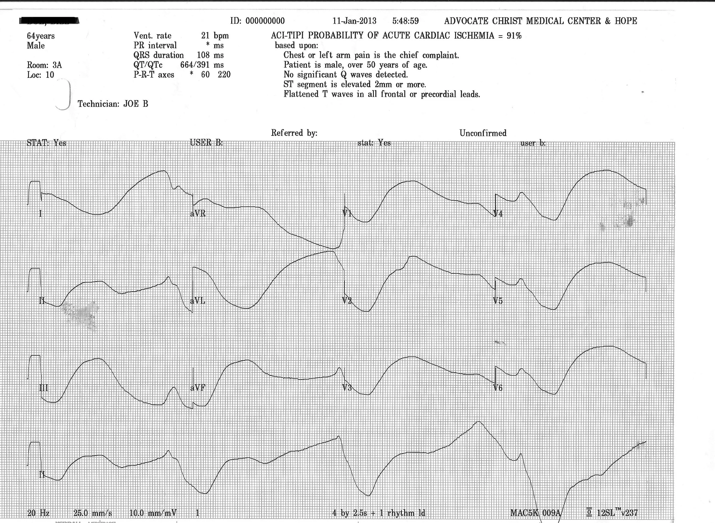 Barounis-EKG1.png