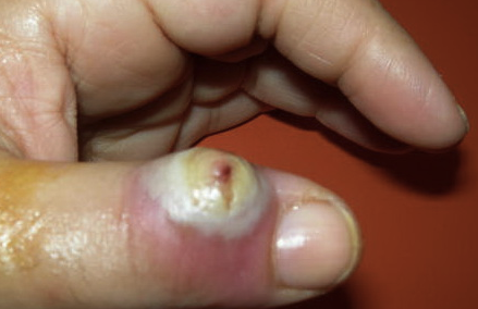 Conference Notes 8-10-2016 — ACMC EM