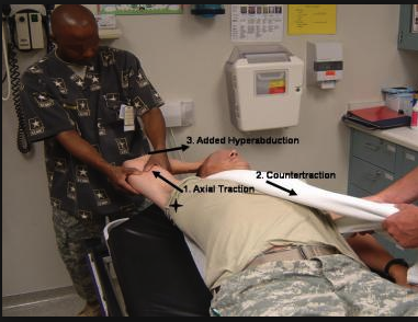Reduction technique for luxatio erecta. Harwood recommends gently walking the arm back down to the patient's side while maintaining traction-counter traction.