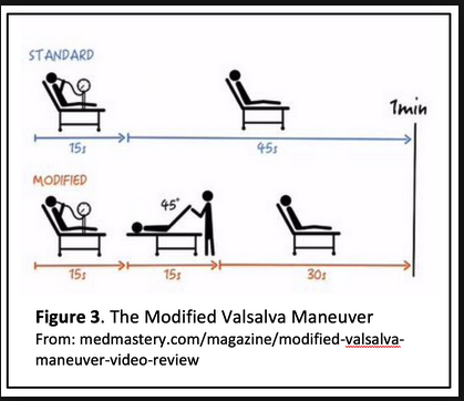 Try this modified valsalva maneuver to terminate SVT. It works 25% of the time.