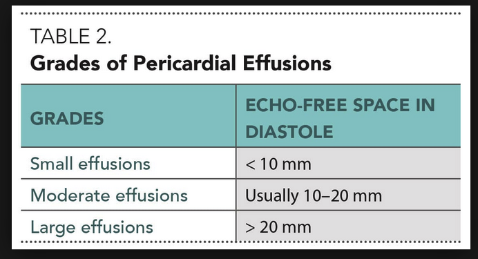 You can measure the width of the pericardial fluid to grade the severity of a pericardial effusion. More than a centimeter (10mm) is significant.