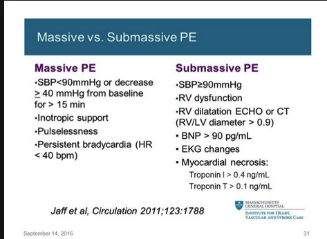 Massive PE patients are candidates for systemic TPA. Sub-massive PE patients are candidates for catheter directed thrombolysis. Patients with a low risk of bleeding who have RV dysfunction and elevated troponin are probably the most likely to benefit from catheter direct thrombolysis in the submassive group.