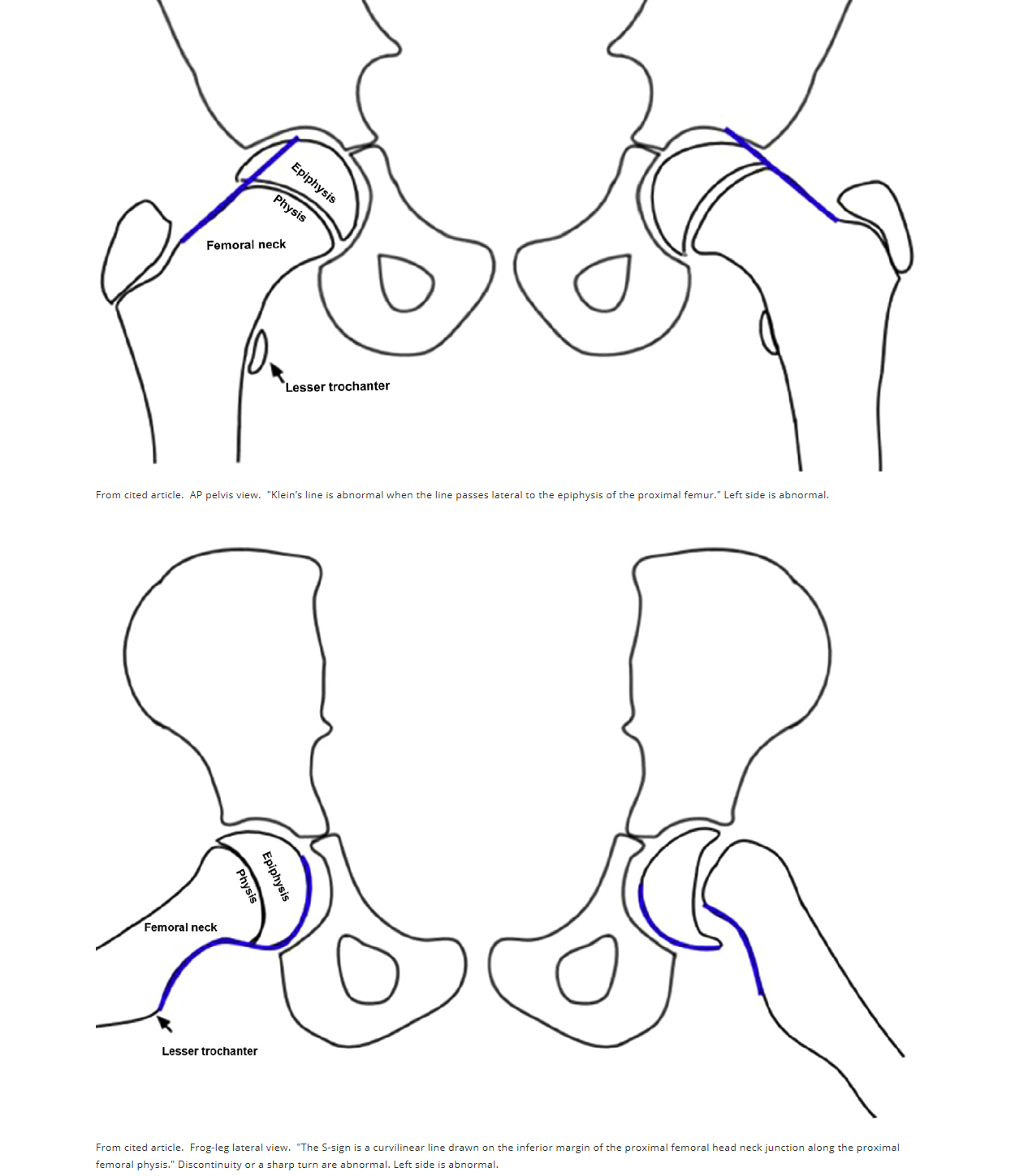 Frog Leg Position Examination