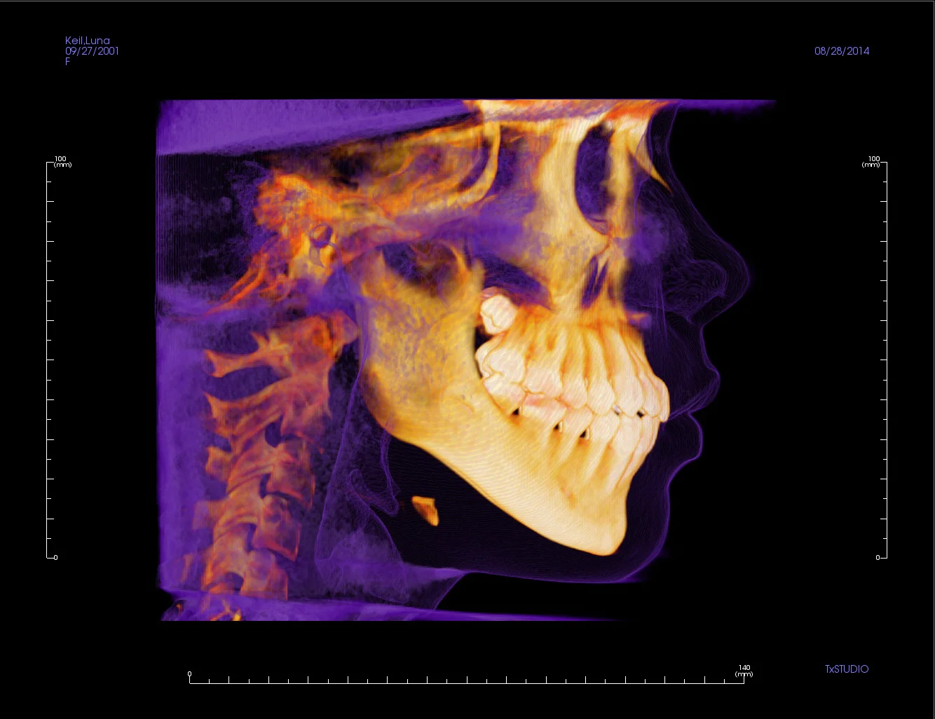 3D X-ray.jpg