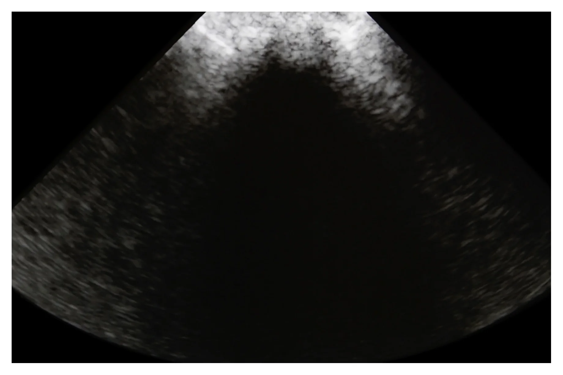 Lauren Altman_Between the Ribs_6_ w x 4_ h_digital print_2018_edition 5 of 12_2018_$150.00.jpg