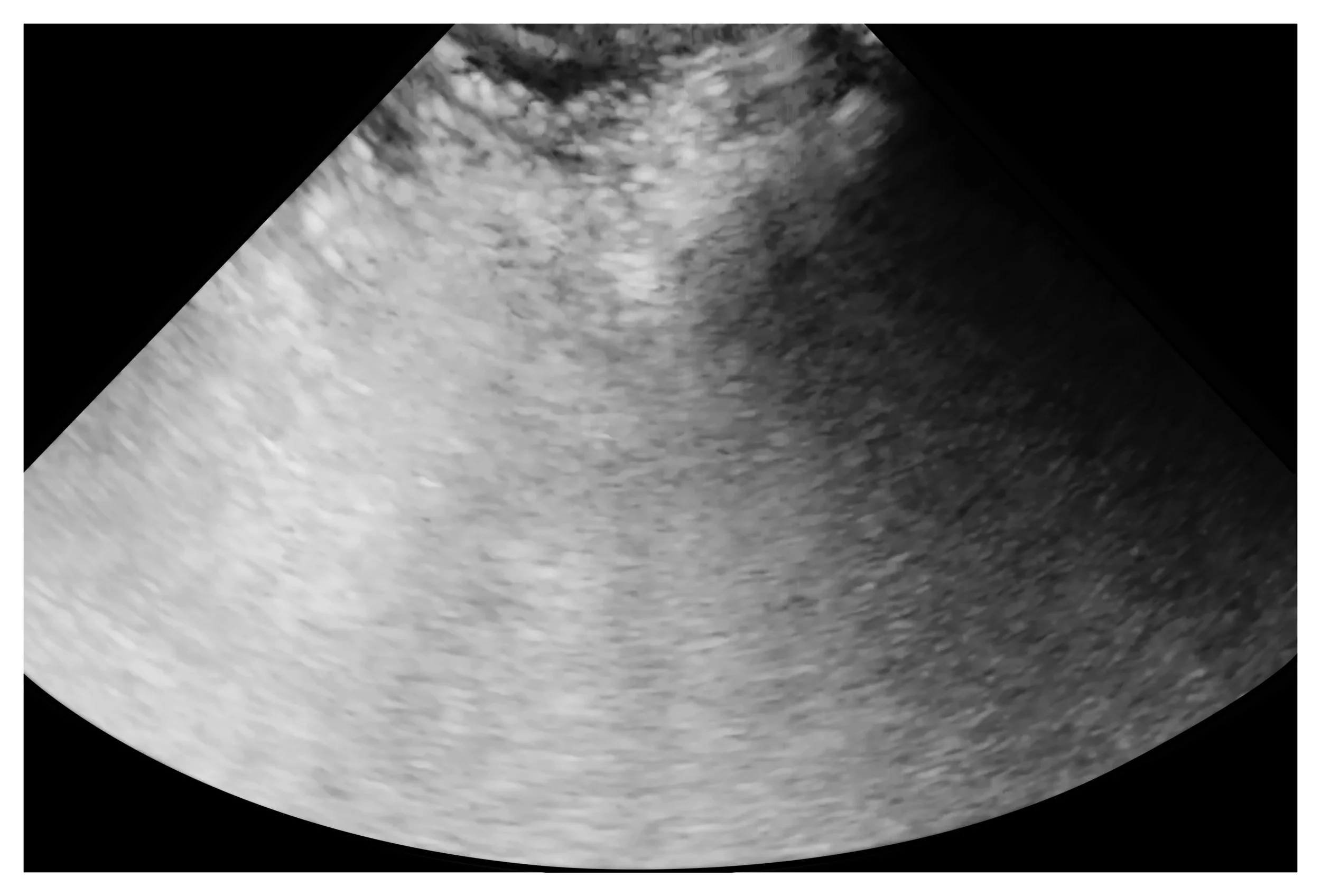 Lauren Altman_Scan I of Between the Ribs_14_ w x 9.5_ h_digital print_2018_$1000.00.jpg