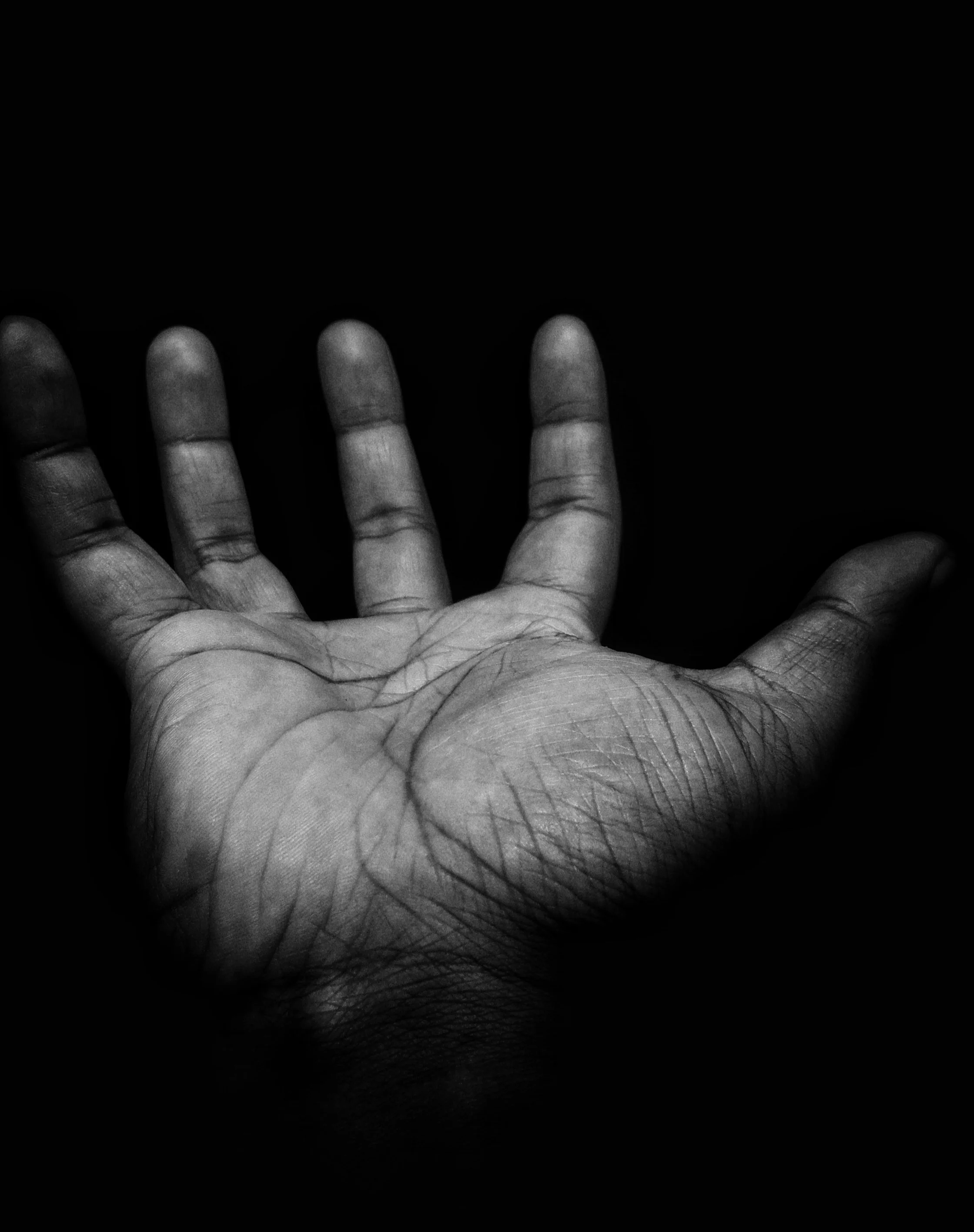 Chemotherapy-Induced Peripheral Neuropathy- CIPN