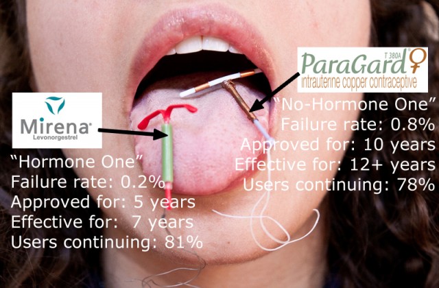 IUDs, or A Detailed Guide to Long-Term Sperm Scarecrows