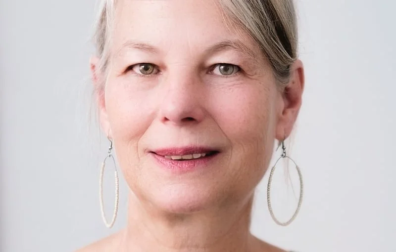 woman had juvederm treatment for wrinkles